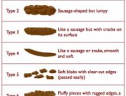 stoolchart